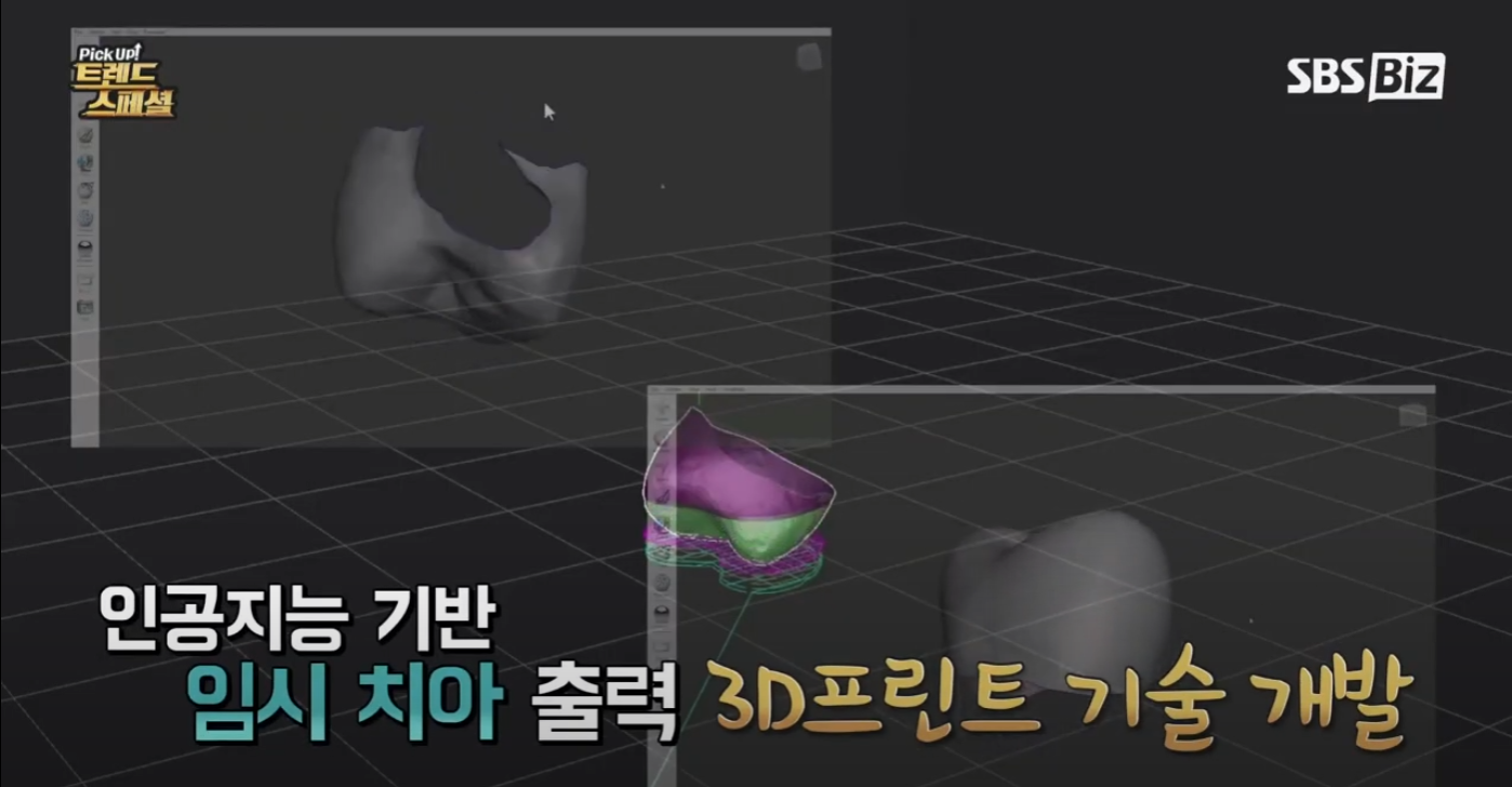 [Pick Up! 트렌드 스페셜] 이젠 치아도 3D프린터로 찍어내다