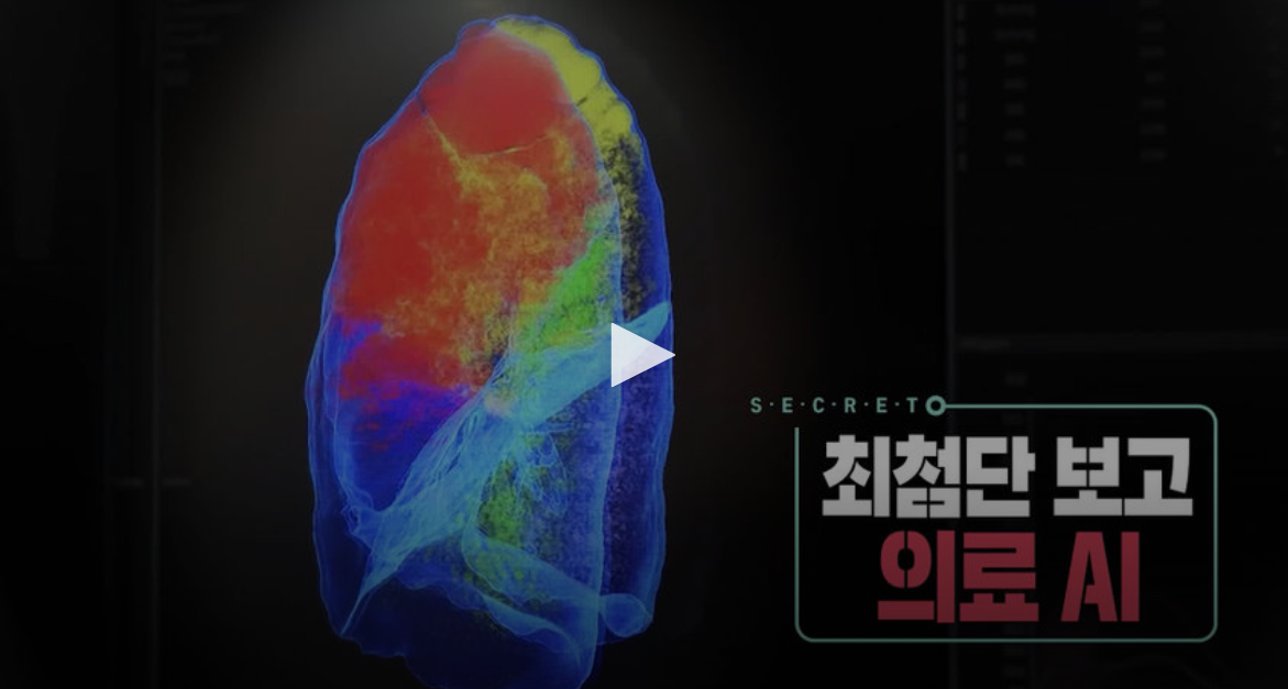 최첨단 보고 - 의료 AI 인공지능의 시대는 우리 곁에 성큼 다가왔다